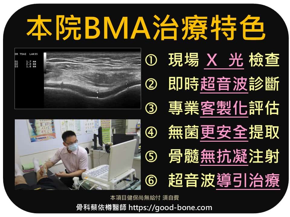 《BMA治療》自體骨髓BMA注射治療-(Bone Marrow Aspirate)-本院特色 - 台中骨科蔡依樽醫師